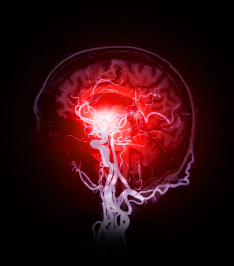 risonanza-magnetica-scaled