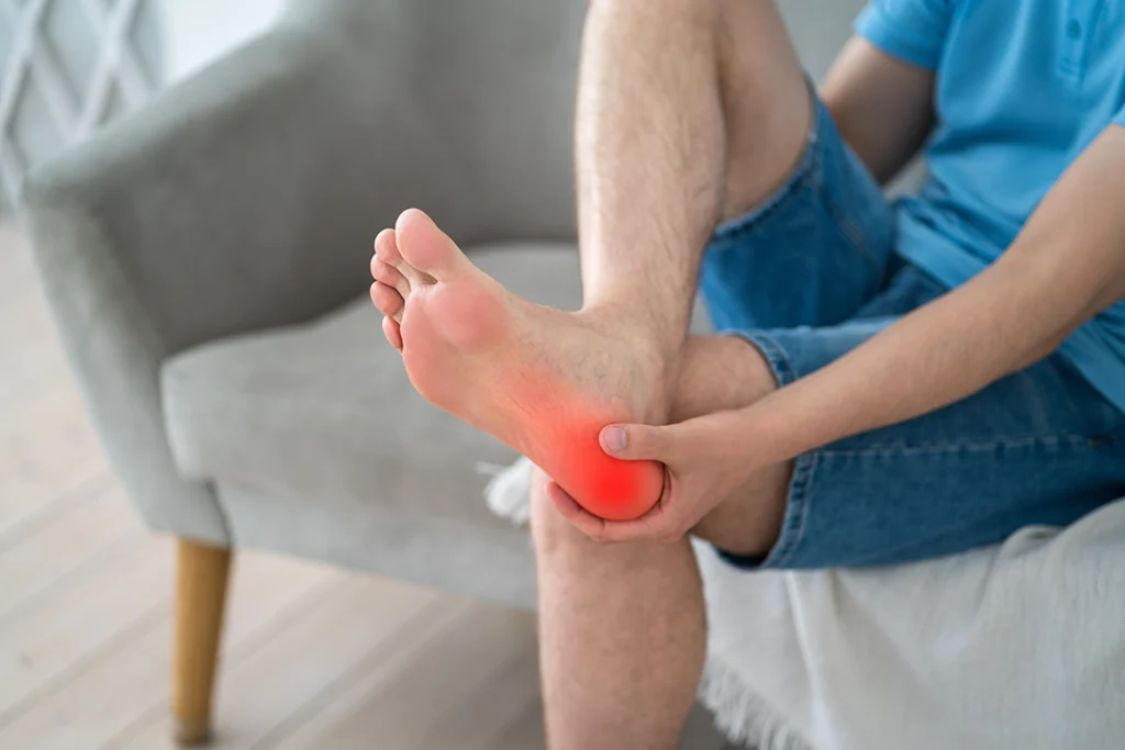Uomo seduto che tiene il piede con espressione dolorante; evidenziata un’area infiammata sul tallone, tipica dello sperone calcaneare