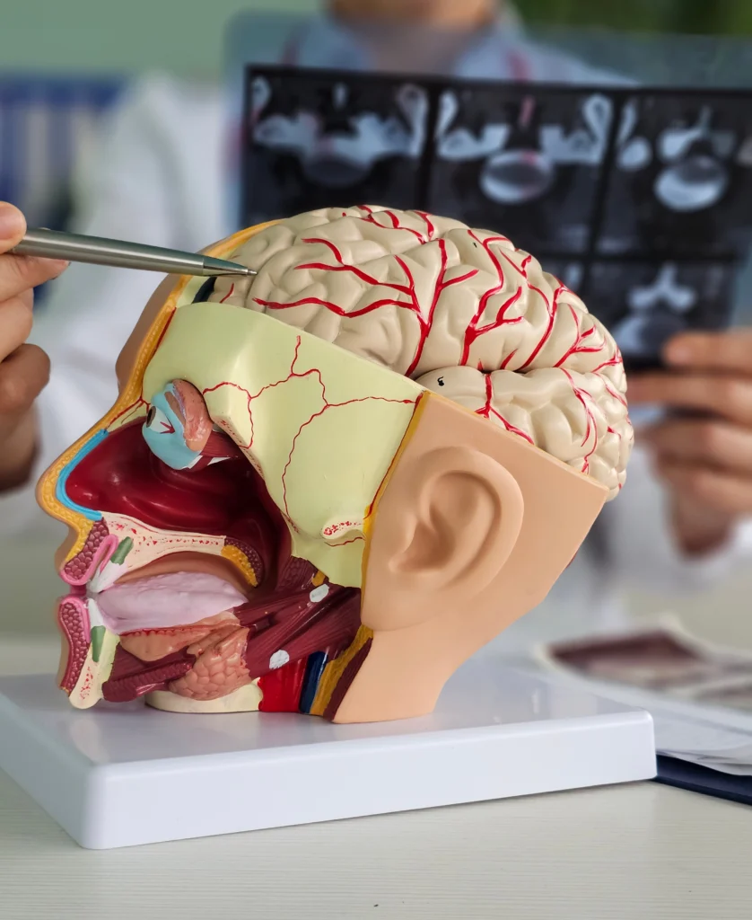 Modello anatomico della testa umana con sezioni del cervello, muscoli e vie aeree, utilizzato da un medico per spiegazioni neurologiche mentre osserva immagini di risonanza magnetica