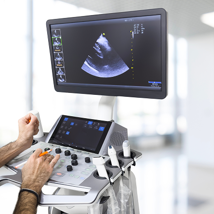 Mano di medico che esegue un'ecografia con sonda e monitor che mostra l'immagine ecografica