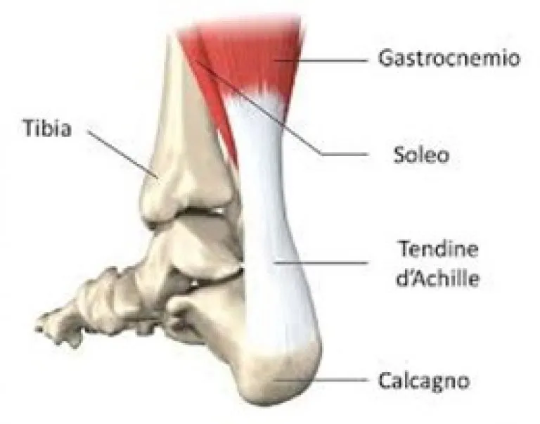 Illustrazione dell'anatomia del tendine di Achille, che mostra le principali strutture coinvolte: gastrocnemio (muscolo del polpaccio), soleo, tibia, tendine d’Achille e calcagno (osso del tallone).