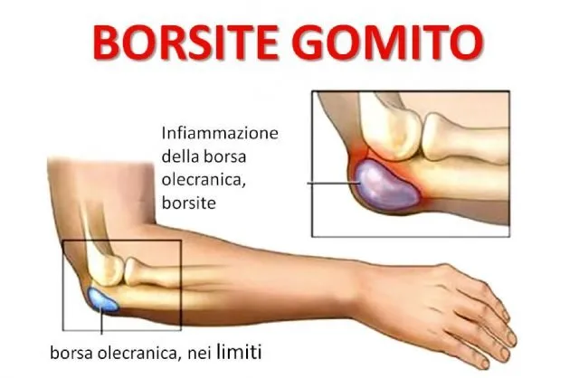 borsite