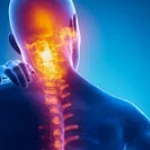 Rendering anatomico con infiammazione della colonna cervicale e dolore irradiato al collo
