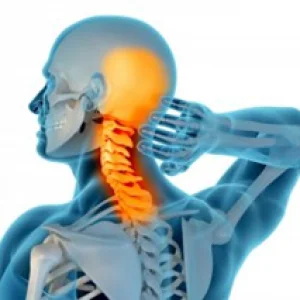 Illustrazione anatomica con evidenziazione della cervicale infiammata, dolore al collo e nuca