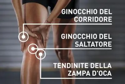 Persona che tiene il ginocchio con tre etichette in italiano: 'Ginocchio del corridore', 'Ginocchio del saltatore' e 'Tendinite della zampa d'oca'