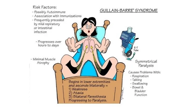 I"Schema illustrativo della sindrome di Guillain-Barré. Una figura umana seduta mostra il decorso della paralisi simmetrica che inizia dagli arti inferiori e risale bilateralmente, causando debolezza, atassia e parestesie. Sono elencati i fattori di rischio (autoimmunità, vaccinazioni, infezioni respiratorie o intestinali), il decorso (progressione in ore o giorni, con atrofia muscolare minima) e i sintomi (problemi respiratori, difficoltà a parlare, deglutire e problemi alla vescica e all’intestino). Una figura di ventilatore e tubo ET suggerisce la possibilità di supporto respiratorio