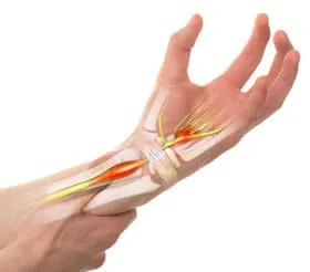 Illustrazione della mano con evidenziazione di nervi e tendini del polso, utile per spiegare le cause della mano neurologica e dei disturbi neuro-muscolari