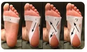 Sequenza di bendaggio funzionale al piede con nastro adesivo, tecnica applicata per sostenere la fascia plantare