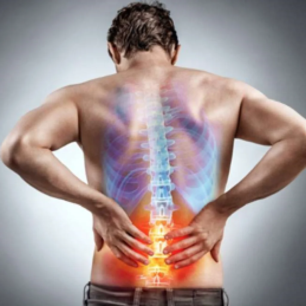 Uomo con dolore lombare evidenziato da immagine anatomica della colonna vertebrale infiammata